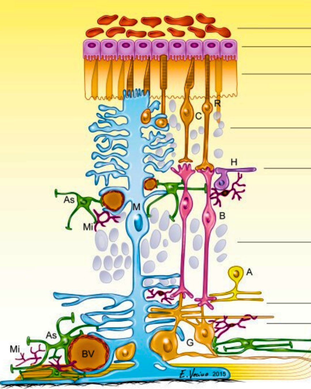 Клітини Мюллера, НАІОН, ішемія сітківки, ішемія зорового нерва