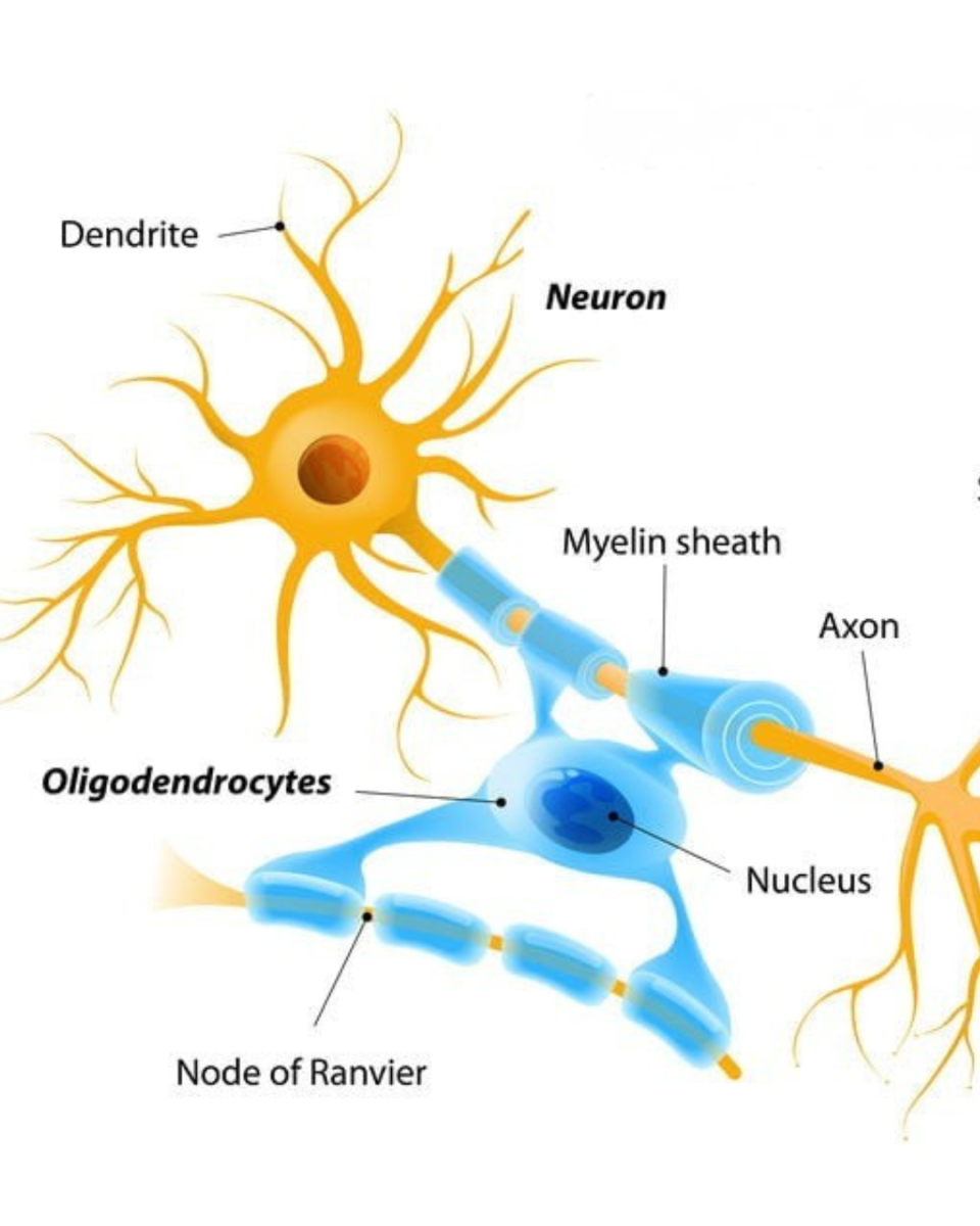 Олігодендроцити, неврит зоровогго нерва, розсіяний склероз, NMOSD, MOG